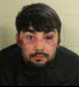 Man Hits Floyd County Deputy in Face During Arrest